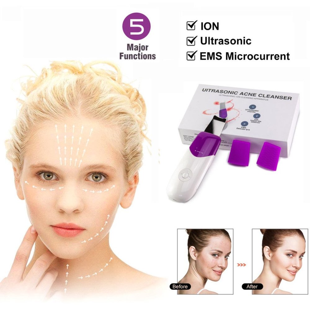 Facial Ultrasonic Skin Scrubber Blackhead Remover